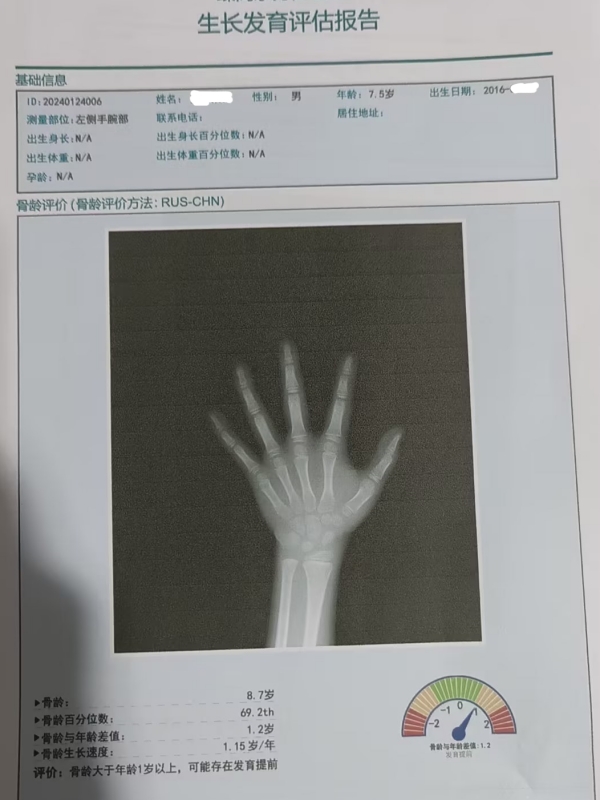 骨齡和身高有什么關(guān)系？每個孩子都有必要檢測嗎？